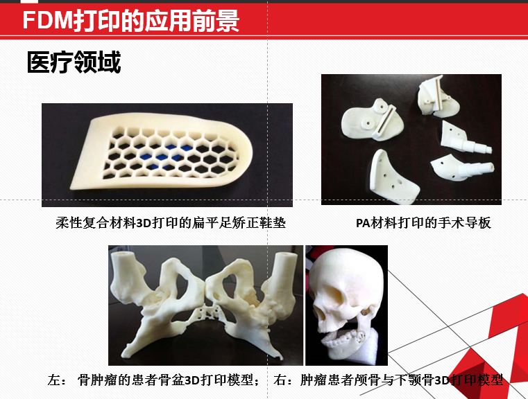 FDM 技術(shù)3D打印機(jī)應(yīng)用領(lǐng)域廣泛，在可預(yù)見(jiàn)的未來(lái)無(wú)可估量！